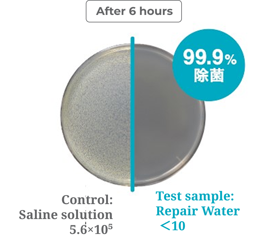 Antibacterial test against Staphylococcus aureus